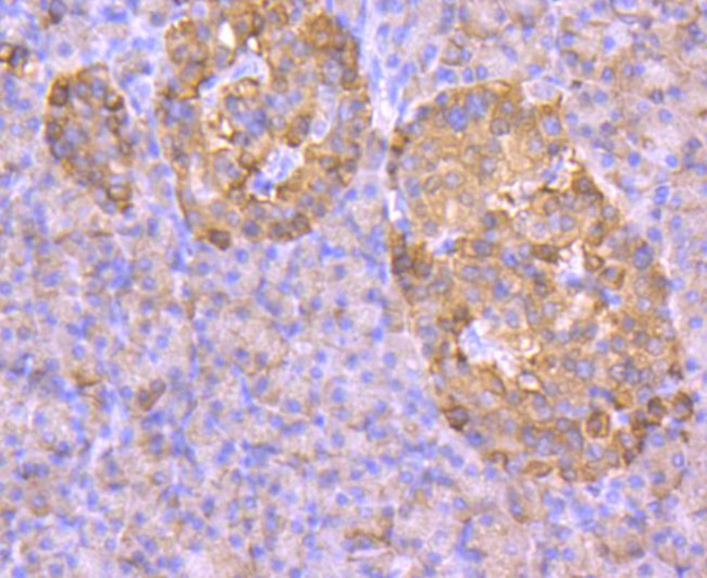 GLUT2 Antibody in Immunohistochemistry (Paraffin) (IHC (P))