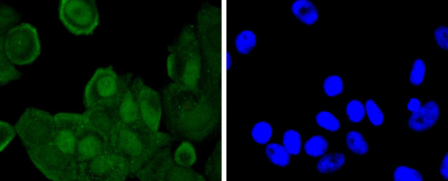 Phospho-JunD (Ser255) Antibody in Immunocytochemistry (ICC/IF)
