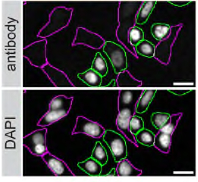 ARID1A Antibody in Immunocytochemistry (ICC/IF)