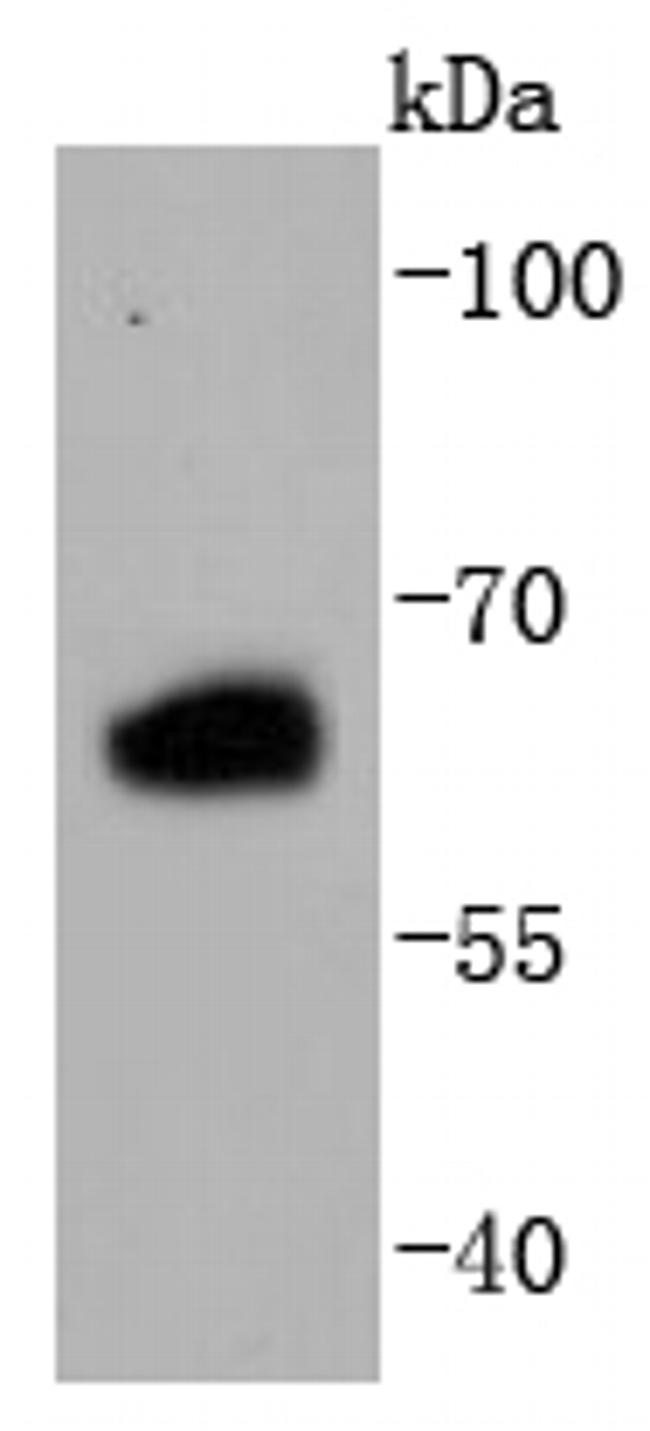 Estrogen Receptor beta Antibody in Western Blot (WB)