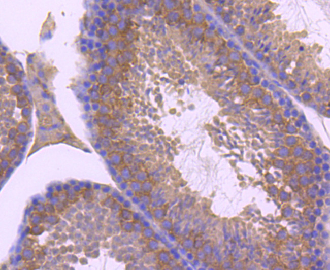 ZNRF2 Antibody in Immunohistochemistry (Paraffin) (IHC (P))