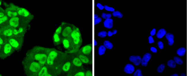 SUMO4 Antibody in Immunocytochemistry (ICC/IF)