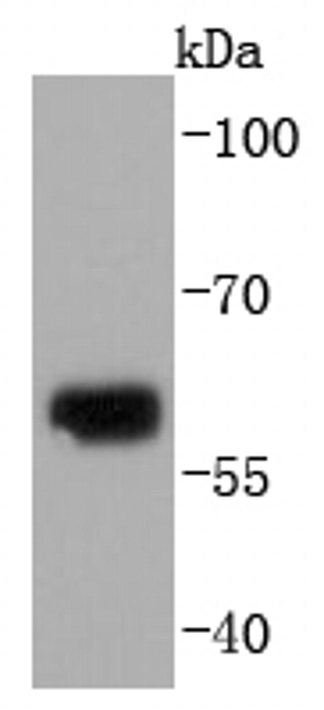 Collagen X Antibody in Western Blot (WB)