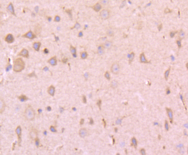 TPA Antibody in Immunohistochemistry (Paraffin) (IHC (P))