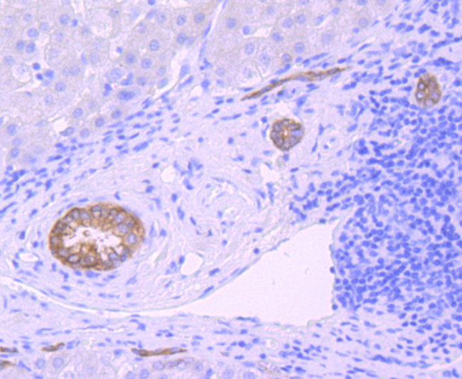 Midkine Antibody in Immunohistochemistry (Paraffin) (IHC (P))