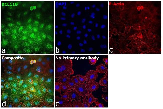 BCL11B Antibody in Immunocytochemistry (ICC/IF)