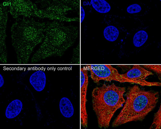 GLI1 Antibody in Immunocytochemistry (ICC/IF)
