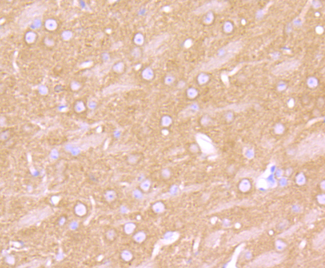 beta-2 Adrenergic Receptor Antibody in Immunohistochemistry (Paraffin) (IHC (P))