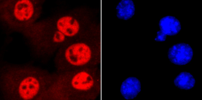 SMC3 Antibody in Immunocytochemistry (ICC/IF)