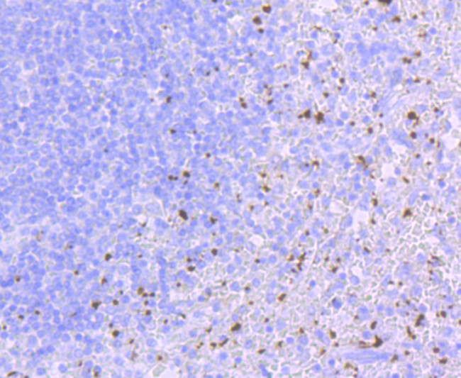 CD41 Antibody in Immunohistochemistry (Paraffin) (IHC (P))