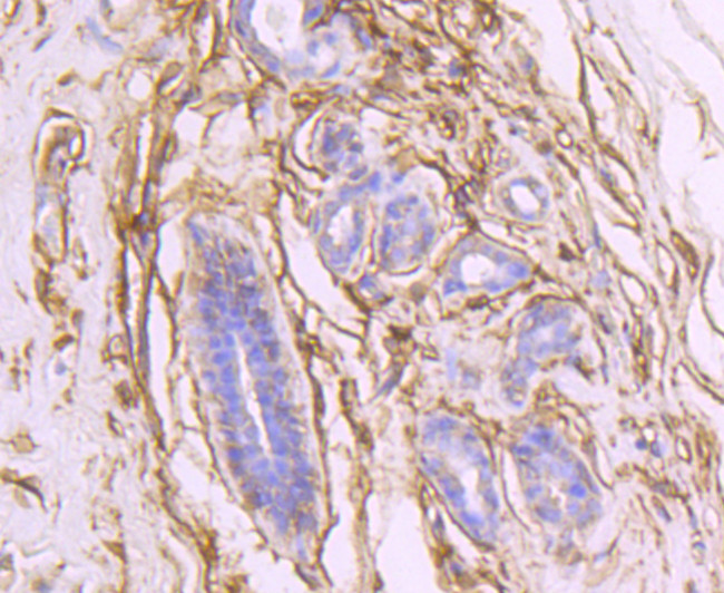 CD73 Antibody in Immunohistochemistry (Paraffin) (IHC (P))