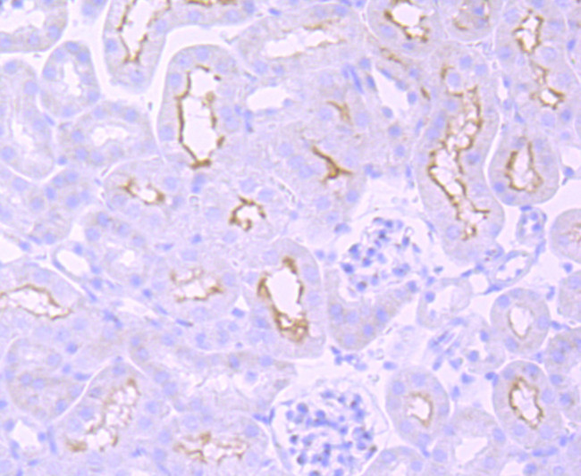 mGluR1 Antibody in Immunohistochemistry (Paraffin) (IHC (P))