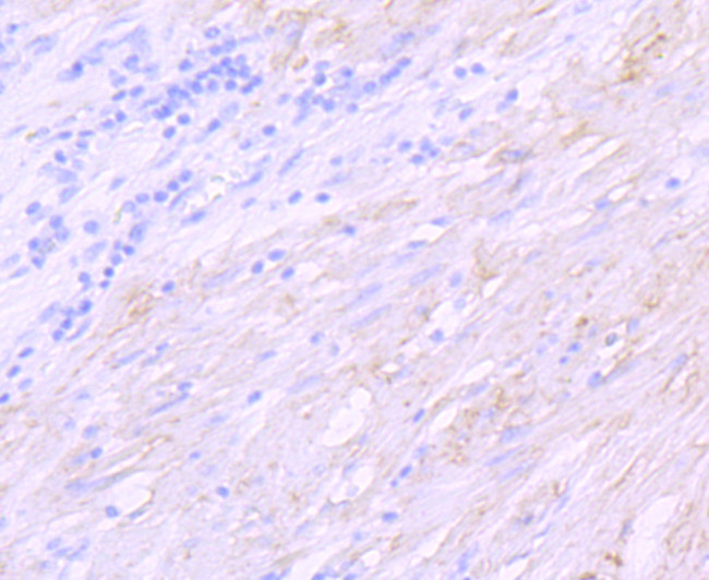 SGCD Antibody in Immunohistochemistry (Paraffin) (IHC (P))