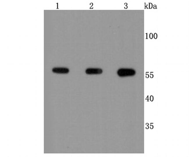 Calcineurin A Antibody in Western Blot (WB)