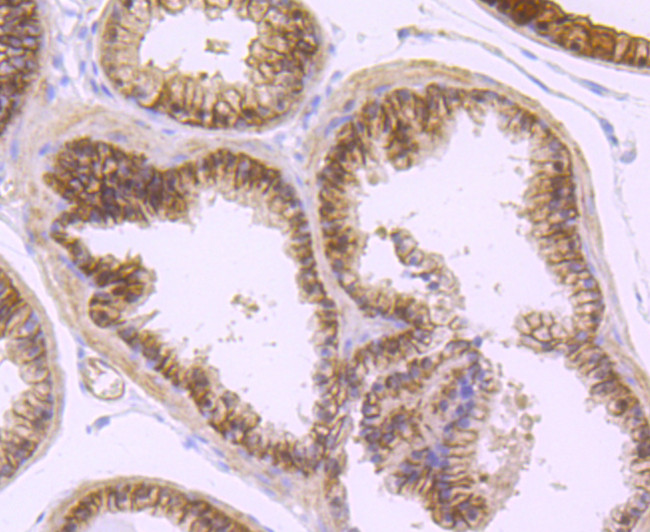 DCLK1 Antibody in Immunohistochemistry (Paraffin) (IHC (P))