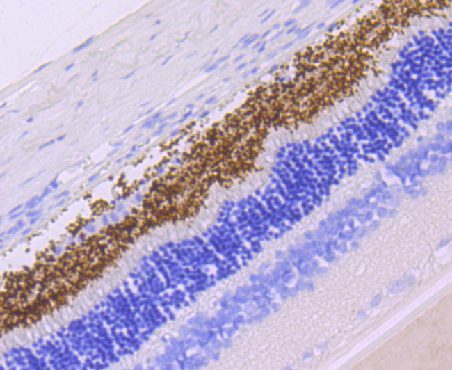 Rhodopsin Antibody in Immunohistochemistry (Paraffin) (IHC (P))