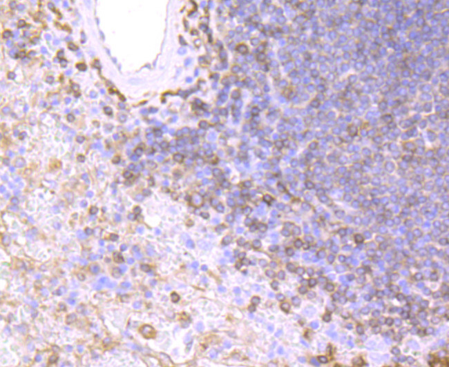 HLA-DPB1 Antibody in Immunohistochemistry (Paraffin) (IHC (P))