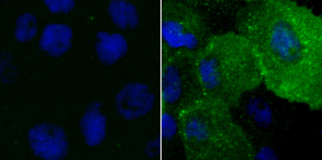Phosphotyrosine Antibody in Immunocytochemistry (ICC/IF)