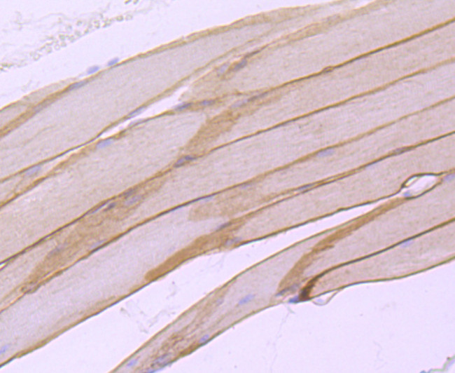 Alpha Sarcoglycan Antibody in Immunohistochemistry (Paraffin) (IHC (P))