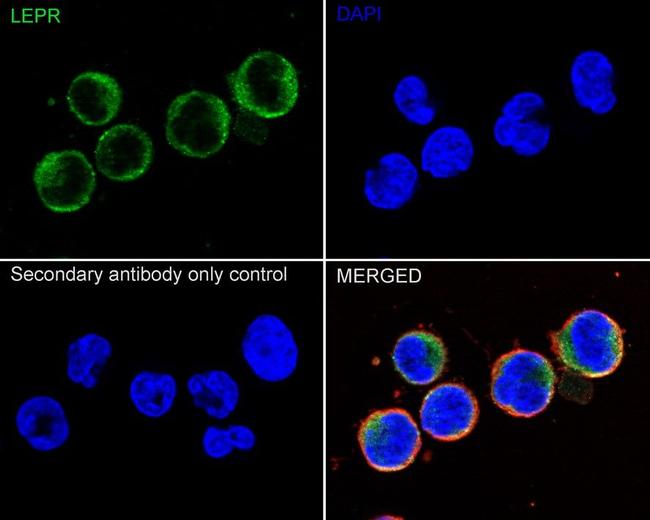 Leptin Receptor Antibody in Immunocytochemistry (ICC/IF)