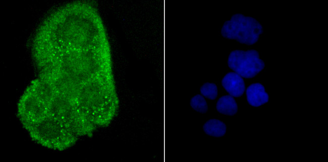 CRYAB Antibody in Immunocytochemistry (ICC/IF)