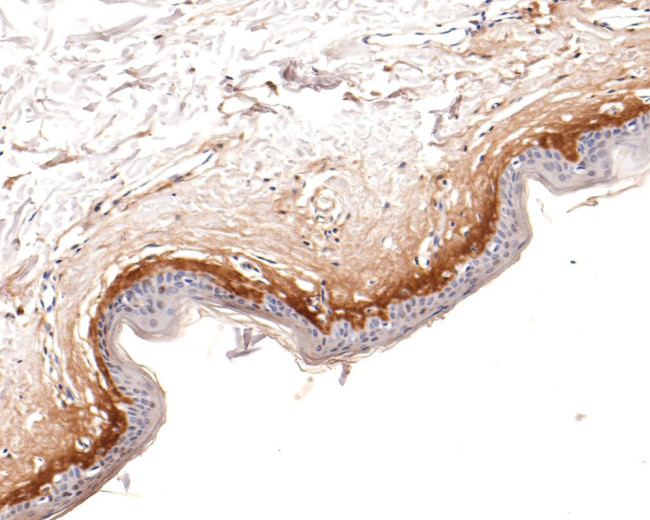 Periostin Antibody in Immunohistochemistry (Paraffin) (IHC (P))