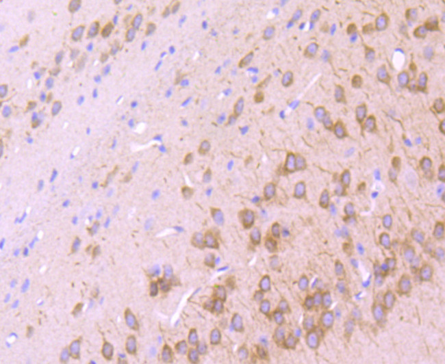 IP3 Receptor 1 Antibody in Immunohistochemistry (Paraffin) (IHC (P))