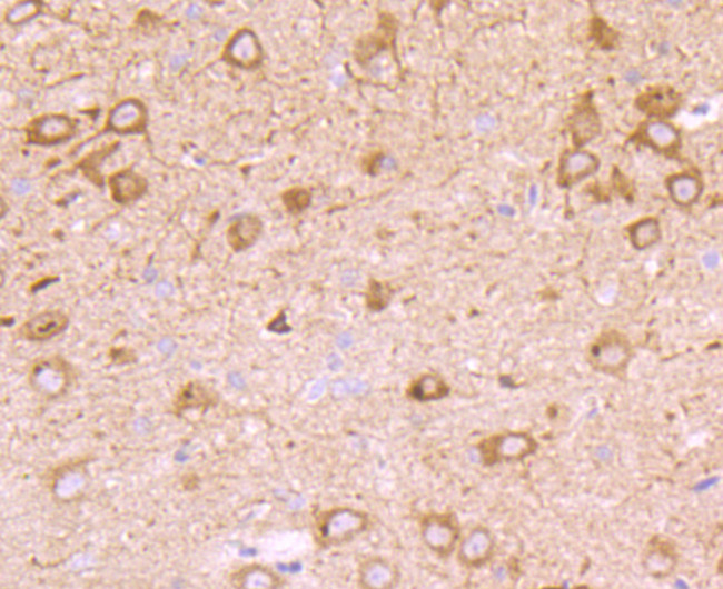 PMP22 Recombinant Monoclonal Antibody (JM52-30) (MA5-32726)