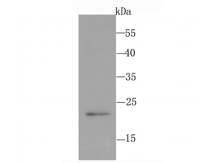 PMP22 Antibody in Western Blot (WB)