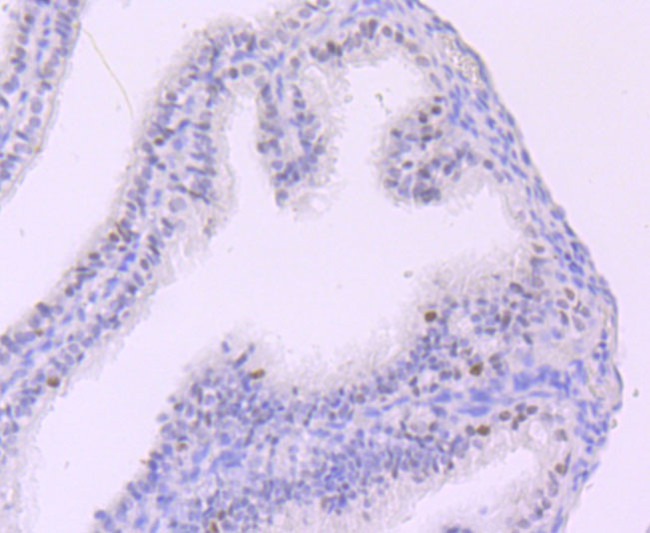 MYST2 Antibody in Immunohistochemistry (Paraffin) (IHC (P))