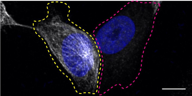 TUBA4A Antibody in Immunocytochemistry (ICC/IF)