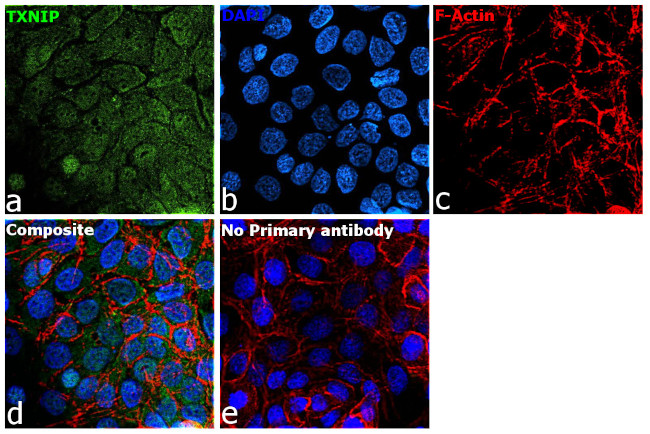 TXNIP Antibody in Immunocytochemistry (ICC/IF)