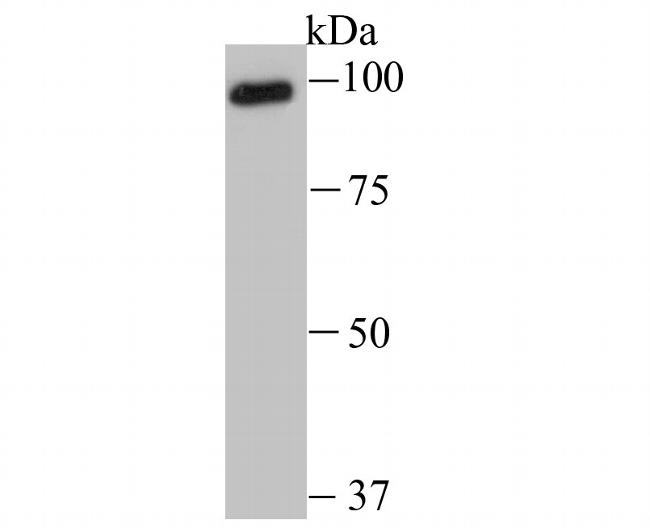 USP13 Antibody in Western Blot (WB)