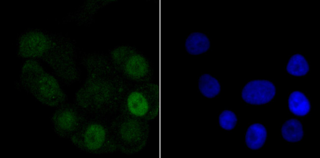 Histone H1.2 Antibody in Immunocytochemistry (ICC/IF)