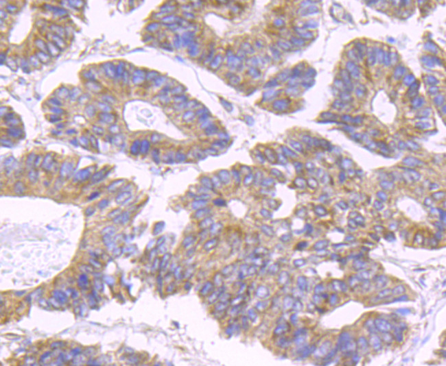 SDHB Antibody in Immunohistochemistry (Paraffin) (IHC (P))