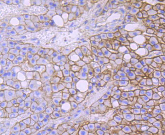 alpha-II Spectrin Antibody in Immunohistochemistry (Paraffin) (IHC (P))