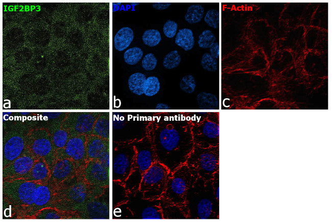 IGF2BP3 Antibody in Immunocytochemistry (ICC/IF)