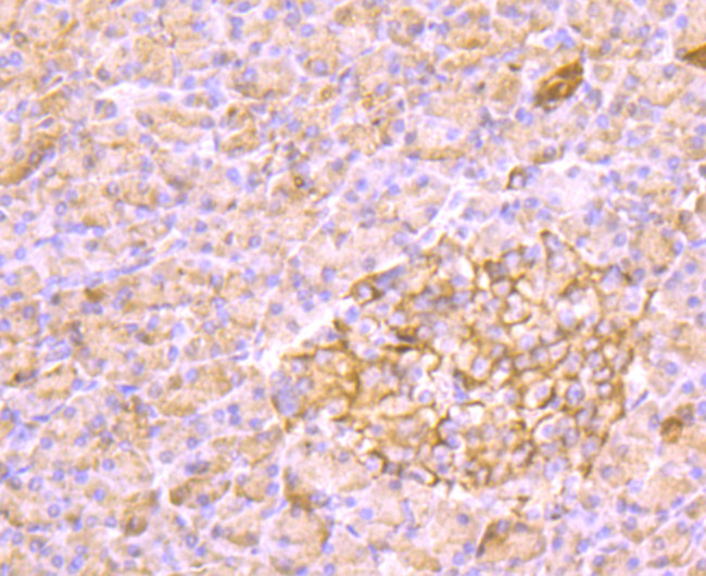 AKR1C1 Antibody in Immunohistochemistry (Paraffin) (IHC (P))