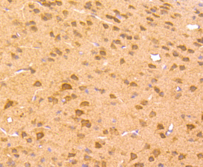 ZIC1 Antibody in Immunohistochemistry (Paraffin) (IHC (P))