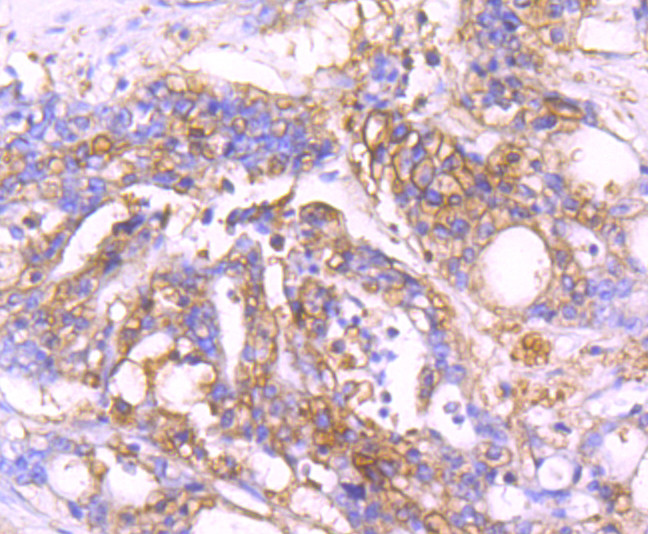 MVP Antibody in Immunohistochemistry (Paraffin) (IHC (P))