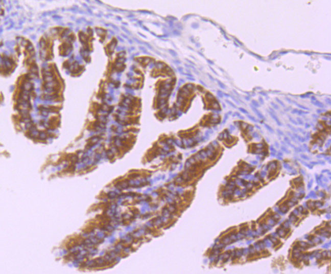 DNAI1 Antibody in Immunohistochemistry (Paraffin) (IHC (P))