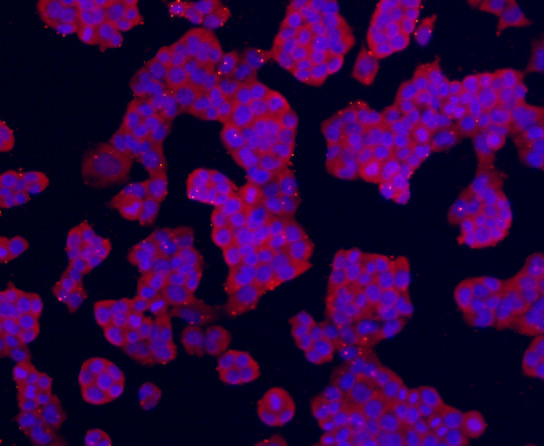 TMEM200A Antibody in Immunocytochemistry (ICC/IF)