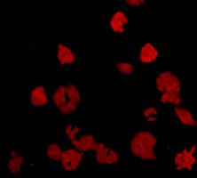KIAA0100 Antibody in Immunocytochemistry (ICC/IF)