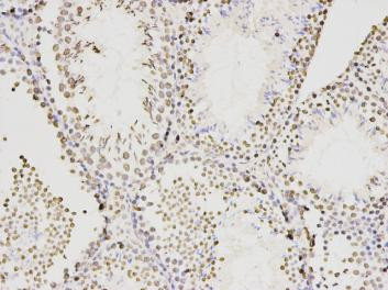 KLDC3 Antibody in Immunohistochemistry (Paraffin) (IHC (P))