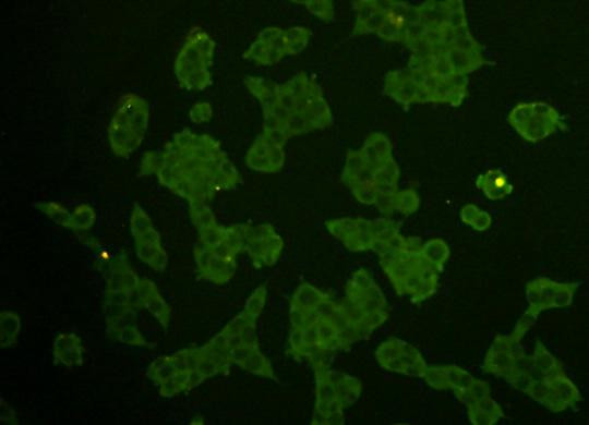 REM2 Antibody in Immunocytochemistry (ICC/IF)