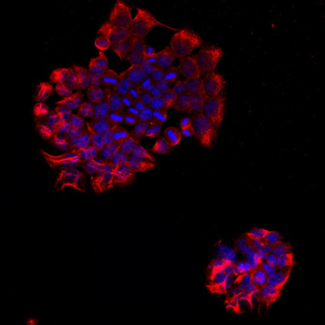 PTPRB Antibody in Immunocytochemistry (ICC/IF)