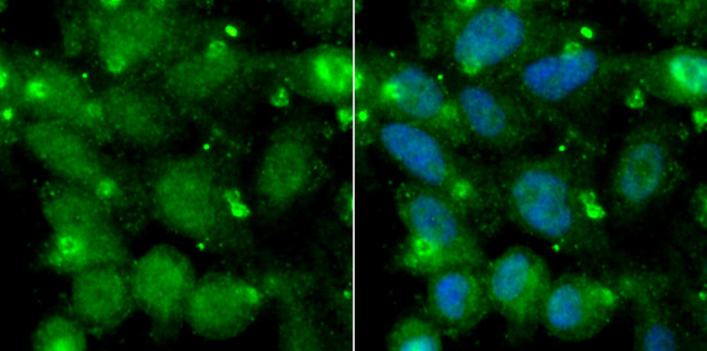 AK6 Antibody in Immunocytochemistry (ICC/IF)