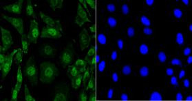 EFTUD2 Antibody in Immunocytochemistry (ICC/IF)