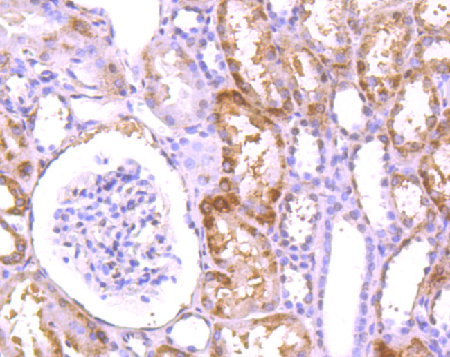 LRRK1 Antibody in Immunohistochemistry (Paraffin) (IHC (P))