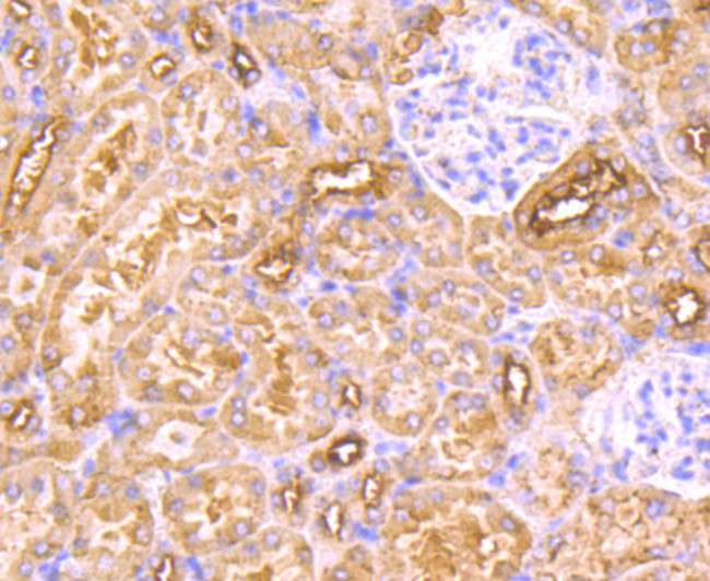 MAL Antibody in Immunohistochemistry (Paraffin) (IHC (P))